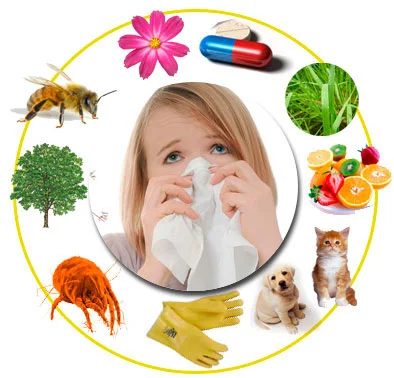 alergia