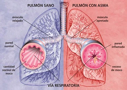 grafica-2